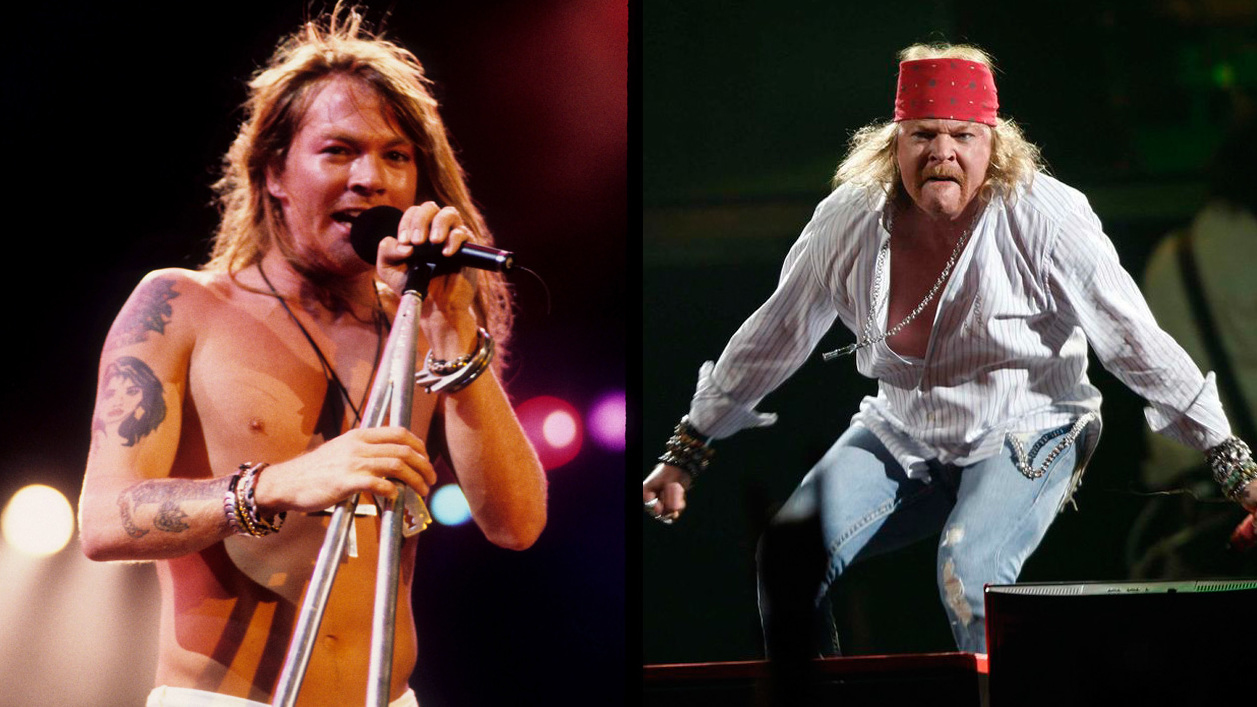 Axl Rose before vs. after