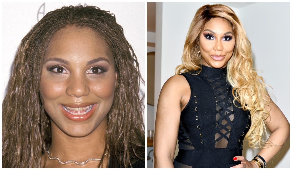 Tamar Braxton before and after 