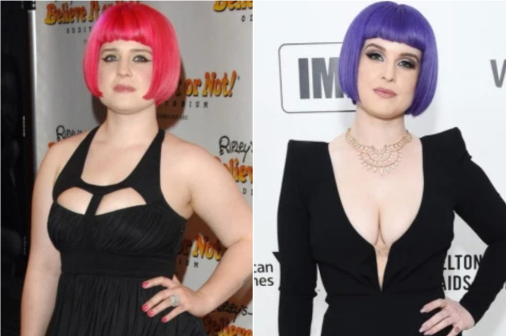 Kelly Osbourne Transformation: Before & After