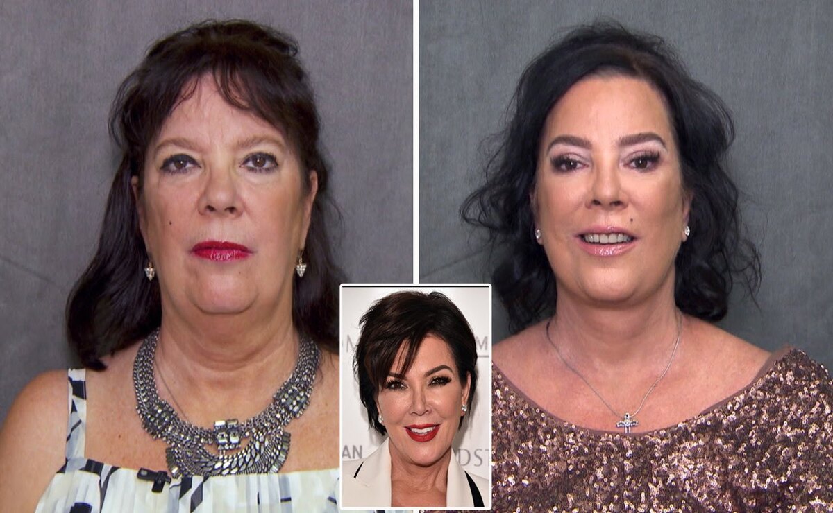 Karen Houghton started looking like her Kris Jenner after the surgery. 