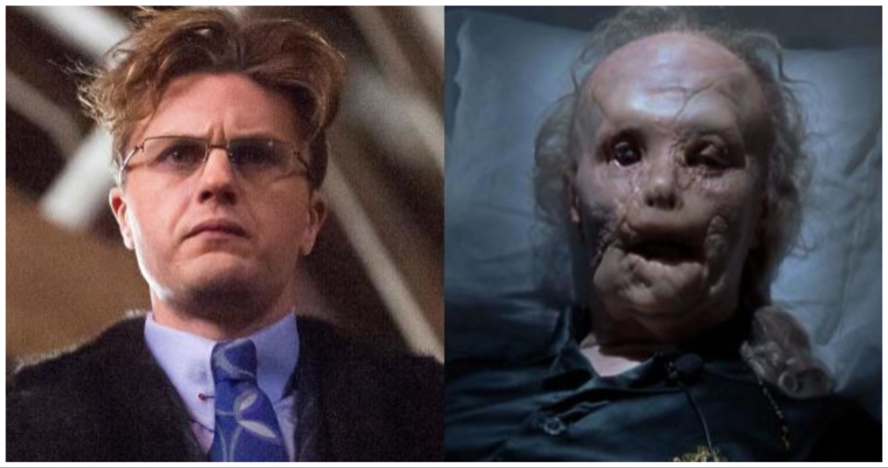 Mason Verger before and after