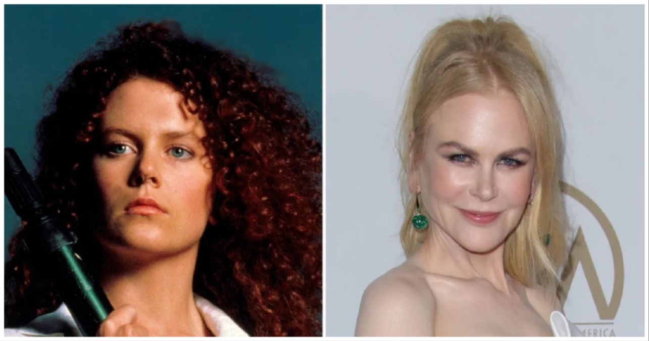 Nicole Kidman before and after