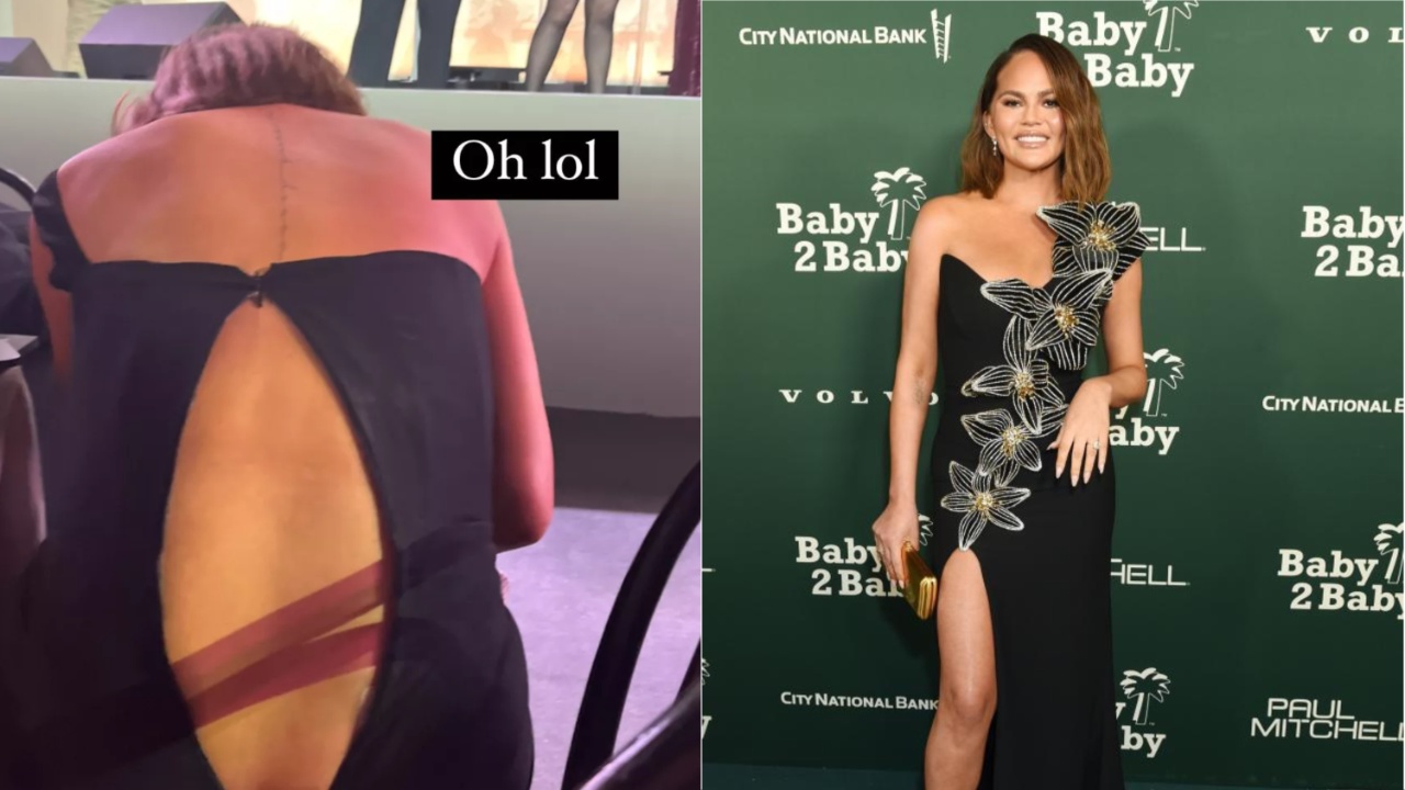 Chrissy Teigen